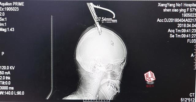 注意防范！北京市發(fā)布大風藍色預警