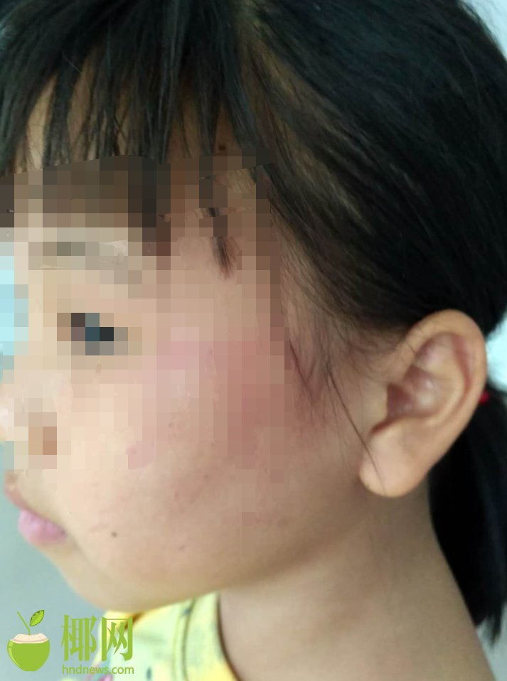 sql注入實驗報告總結(jié)_英超：曼聯(lián)客場4-1狼隊升第6 B費2射1傳