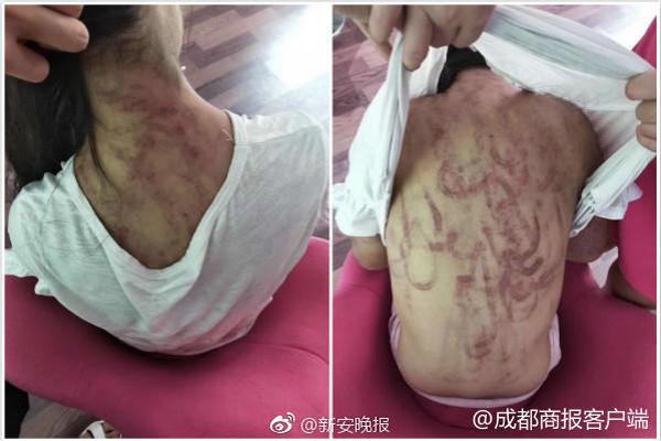 forscan官網(wǎng)下載_戰(zhàn)“疫”行動(dòng) 需要平等之光照耀