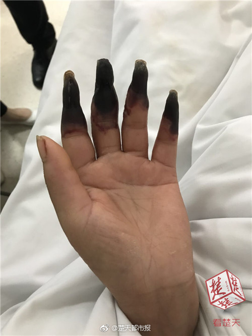 動(dòng)物保護(hù)網(wǎng)頁_2026款比亞迪夏到底改了什么？一句話:更懂生活了