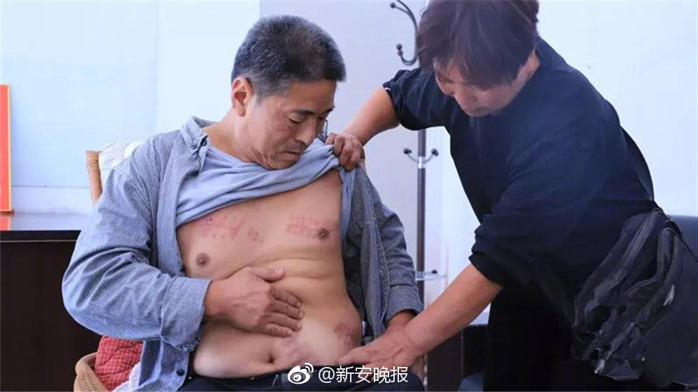 小紅書如何掛其他店鋪鏈接賺取傭金_左大腿腘繩肌損傷，世體：拉波爾特可能因傷缺席兩個月